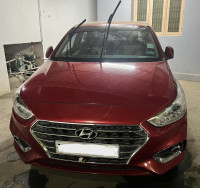 Hyundai Verna SX(O) D 2017 Model